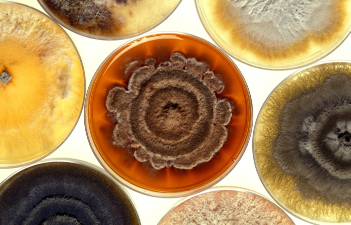 bacteria growing in petrie dishes