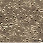 E. coli bacteria