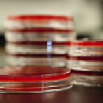 TB testing to continue into January