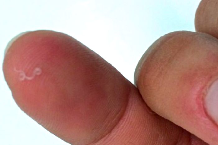 An adult Thelazia gulosa removed from the eye of a human and shown here on a person’s finger. (CDC.gov)
