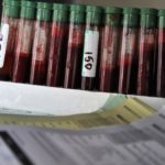 This file photo shows a rack of blood samples being tested for bovine tuberculosis in New Zealand dairy cattle. (Lakeview_Images/iStock/Getty Images)