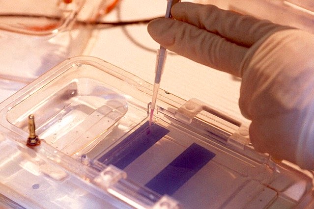 Tests of potato genetic material, loaded onto an agarose gel, show the presence of an experimental gene. (Ken Hackman photo courtesy ARS/USDA)
