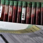 This file photo shows a rack of blood samples being tested for bovine tuberculosis in New Zealand dairy cattle. (Lakeview_Images/iStock/Getty Images)