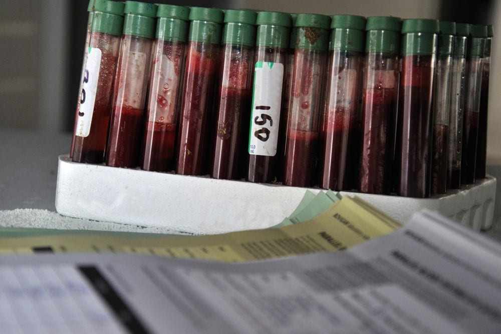 A row of labelled blood sample vials with green caps in a holder, with testing paperwork visible underneath. Photo: Getty Images
