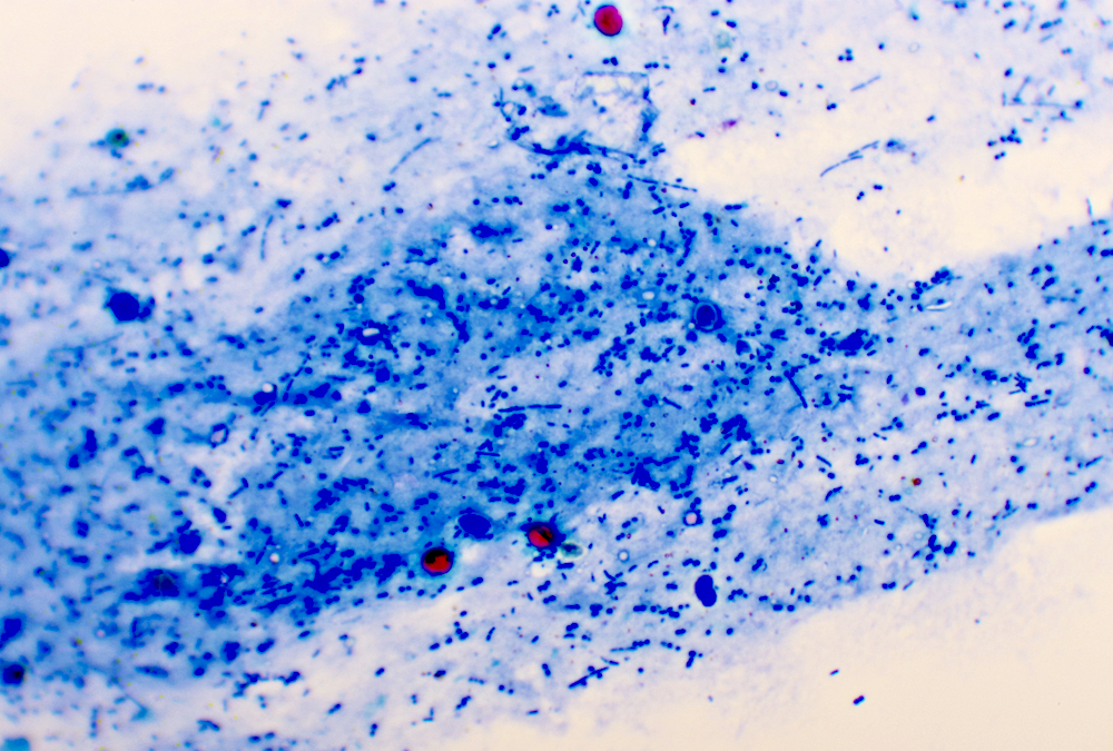 Microscope image showing blue-stained cryptosporidium parvum oocysts with several red-stained organisms visible against a light background. Photo: Getty Images
